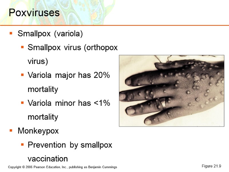 Poxviruses Smallpox (variola) Smallpox virus (orthopox virus) Variola major has 20% mortality Variola minor